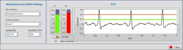ecg.jpg